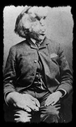 Joseph Merrick